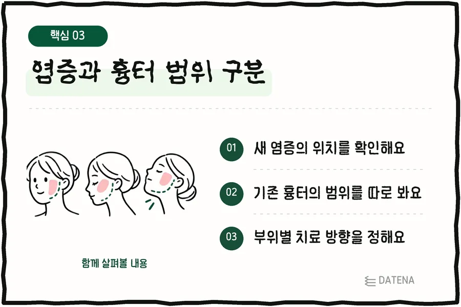 염증과 흉터 범위 구분: 새 염증의 위치를 확인해요; 기존 흉터의 범위를 따로 봐요; 부위별 치료 방향을 정해요 — 다태나의원 설명 카드