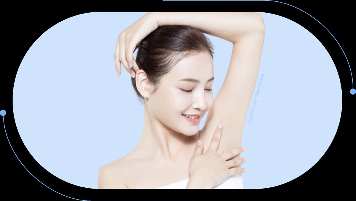 제모 레이저 안내 4