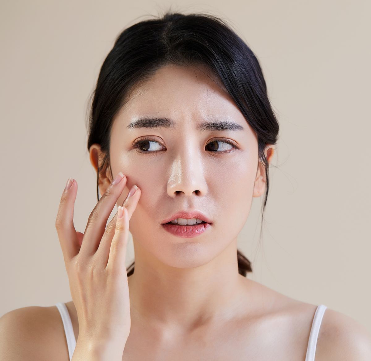 여드름흉터 치료 안내 4