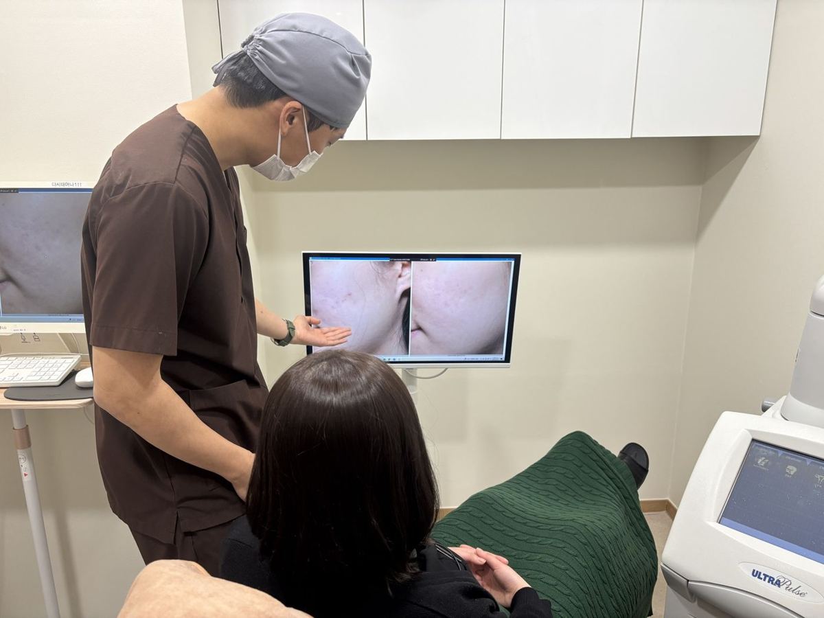 여드름흉터 치료 안내 23
