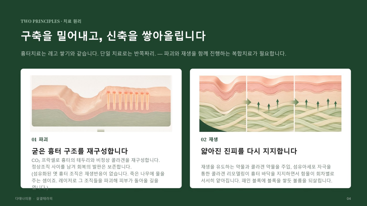 살결테라피 상담자료 4